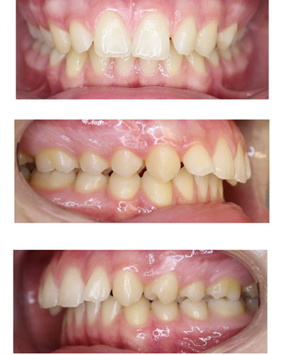 Before Image